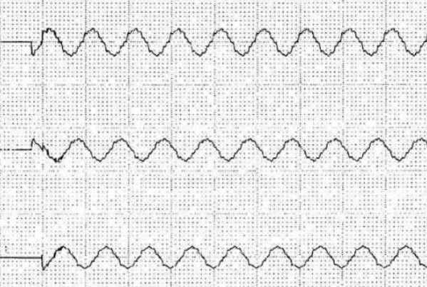 電容補(bǔ)償柜用晶閘管開關(guān)投切時(shí)波形圖